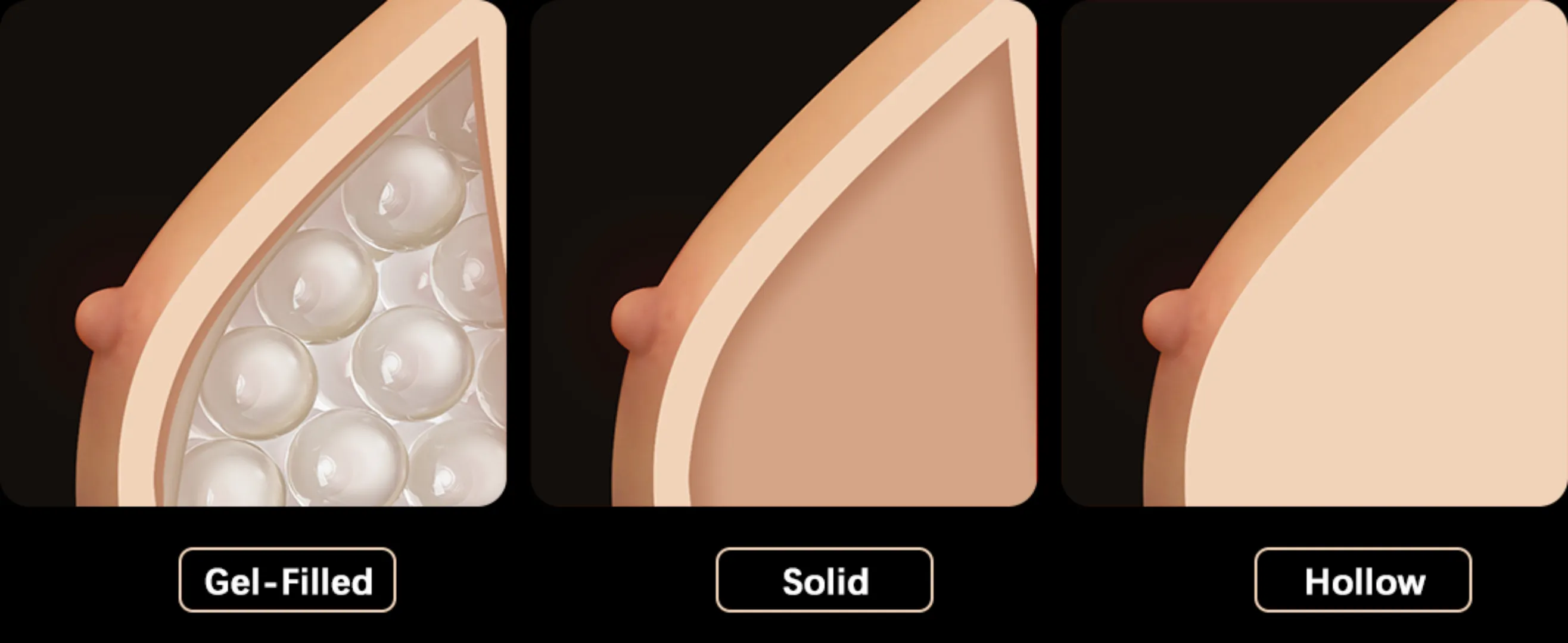 Breast style
