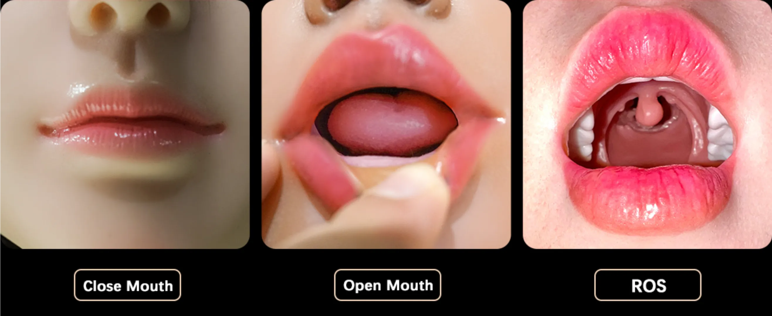 Mouth